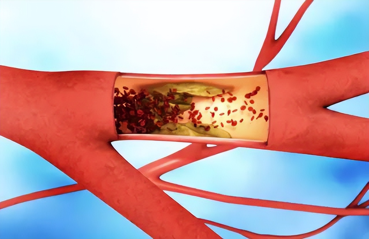 心脏跳动慢是什么情况,运动后心脏跳动突然慢