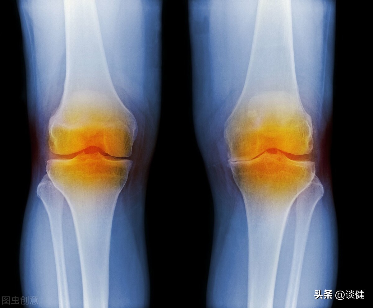 关节退化应该注意什么,关节退化的最好治疗方法