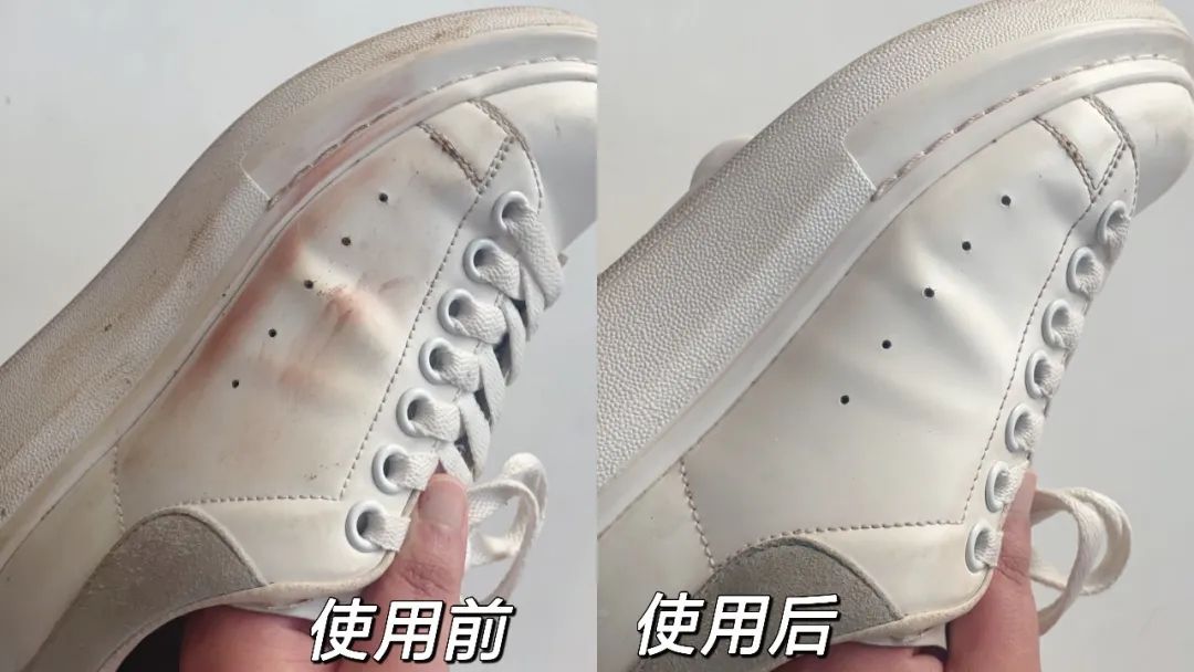 小白鞋脏了刷不下来有什么小妙招,小白鞋很脏怎么清洗没有白醋
