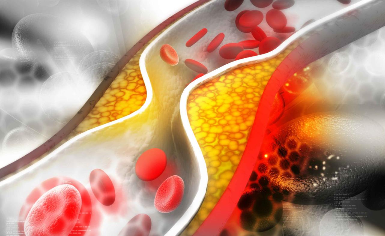 新研究：吃对零食能防心脏病,伟哥治疗心脏病