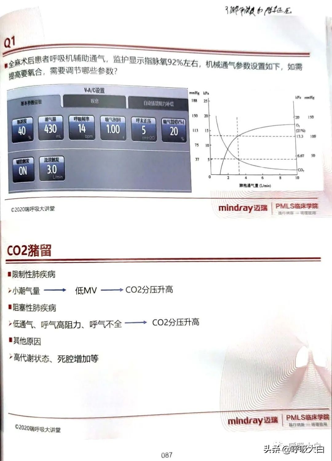 呼吸机epr怎么调节,呼吸机如何调节温度