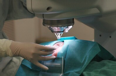 激光近视手术官司,近视眼激光手术算病假吗