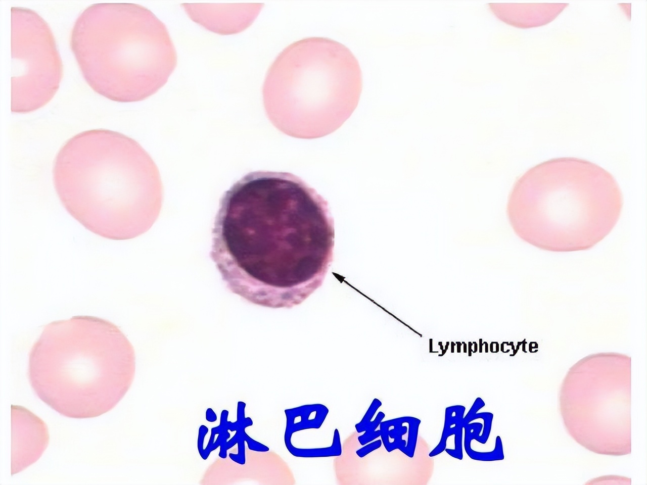 血常规都可以检查出什么病啊,血常规能检查出传染病四项