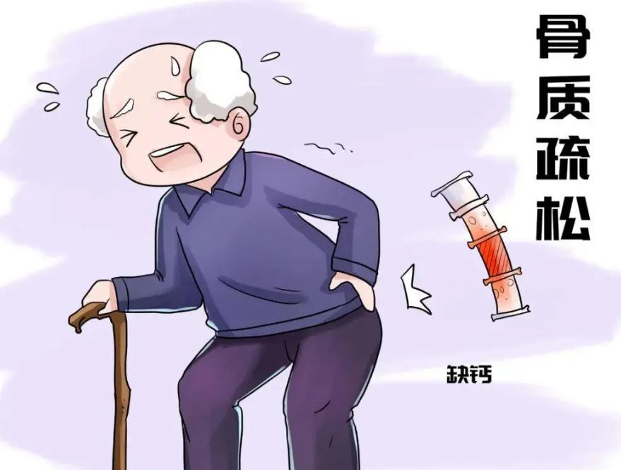 儿童骨密度检测中bmi正常范围,34岁骨密度检测说骨质疏松怎么办