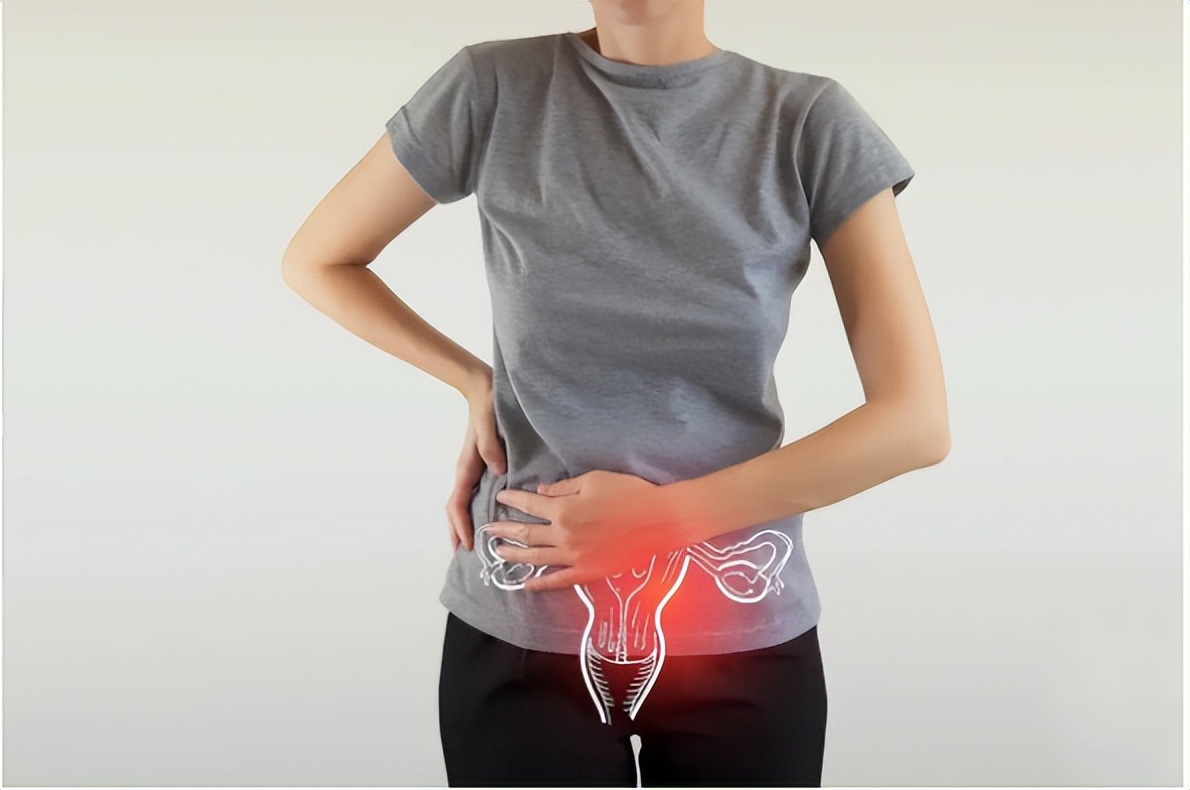 大部分女性逃避妇科检查，其原因是“鸭嘴钳”