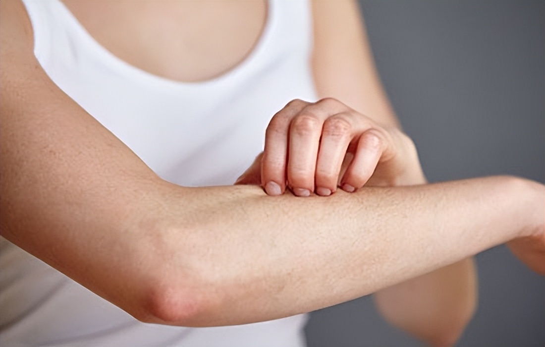 冬天皮肤瘙痒起红疹子越挠越痒,为什么一到冬天就浑身瘙痒