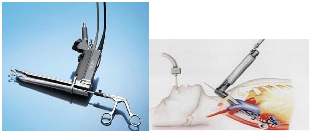 杨弘中山大学肿瘤,杨弘医生怎么样