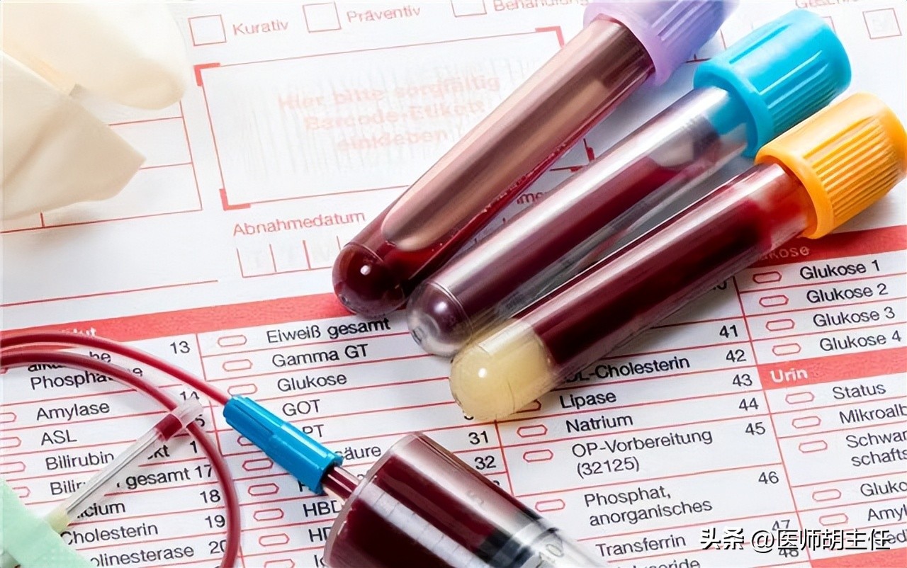 肝病胆红素偏高怎么才能降下来,体检胆红素偏高怎么快速降低