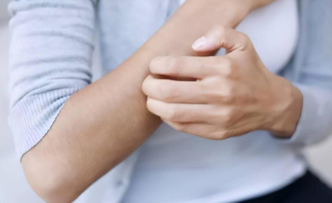 炉甘石洗剂贵的与便宜的有区别吗,炉甘石洗剂世卫推荐