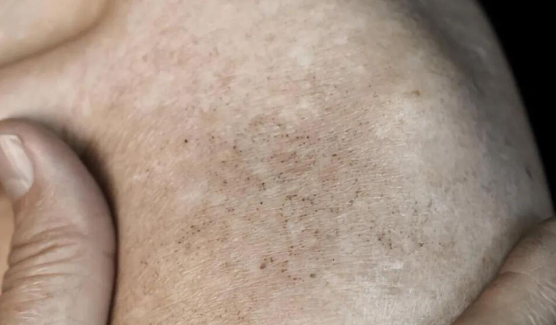 40岁女性下眼皮发黑是什么原因,女性腹股沟发黑是什么原因怎么办