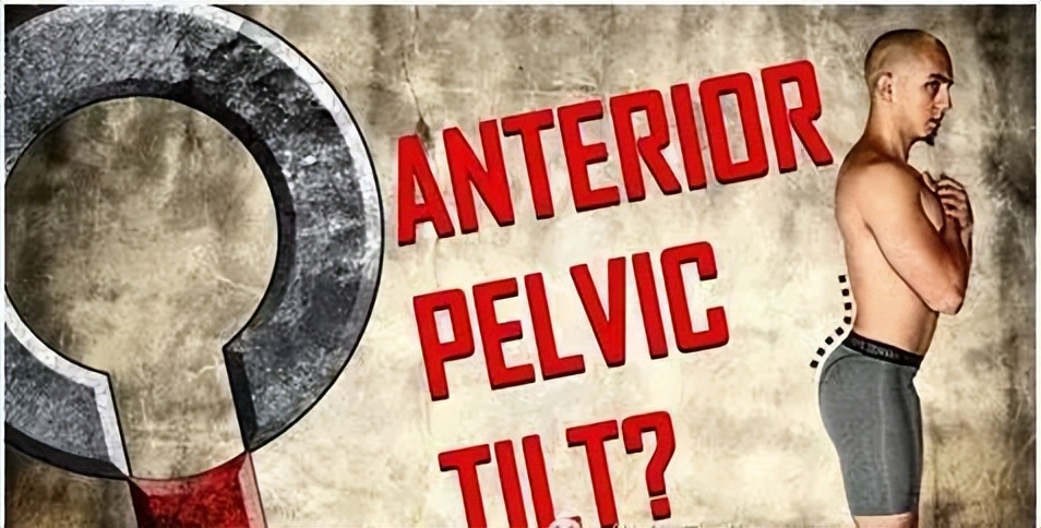 矫正骨盆后倾其实很简单,骨盆后倾矫正最简单的动作