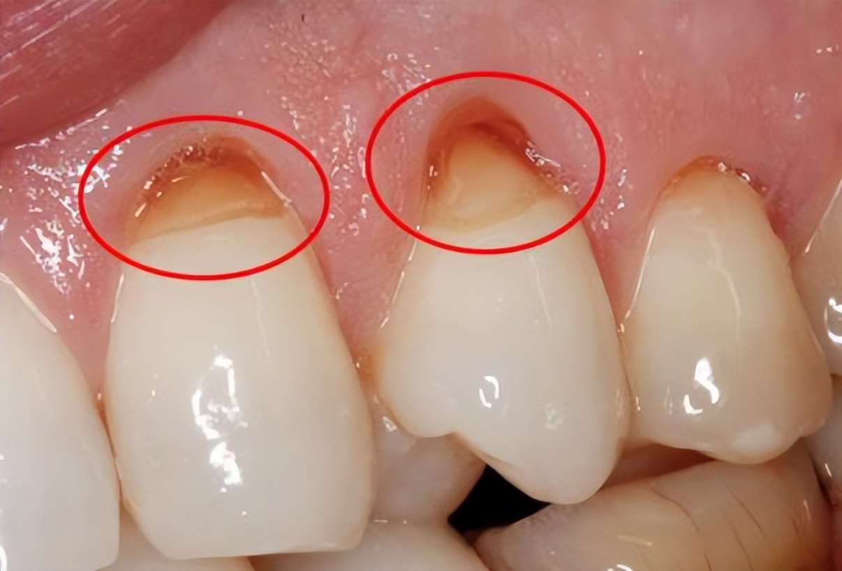 儿童牙刷怎么选择好用一点,3-6岁儿童应该怎么选牙刷