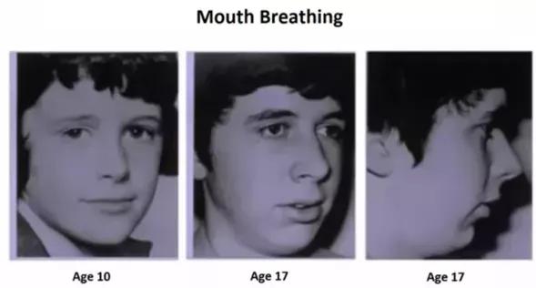 这五个坏习惯真的会让孩子变丑,这些小习惯让你变丑