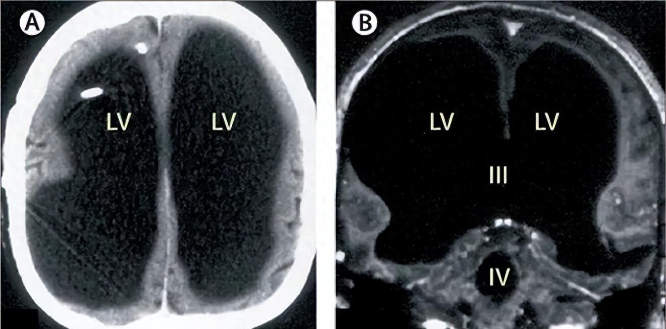 15个活久见的事实:阴道里长了“牙齿”,14世纪的“乳房袋”