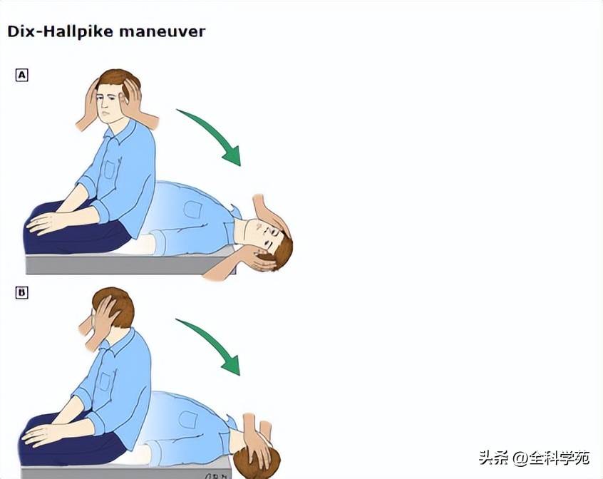 眩晕评估量表,眩晕的病情评估