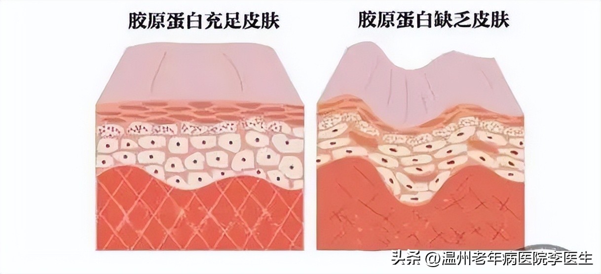 淡斑超光子,美白嫩肤光子