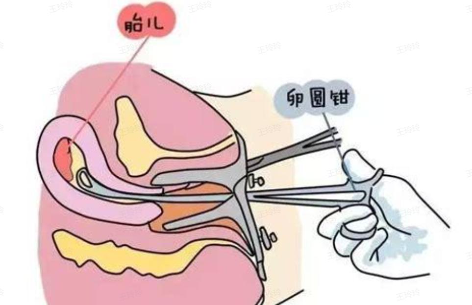 人到中年还需要爱情吗,人到中年还需要朋友吗