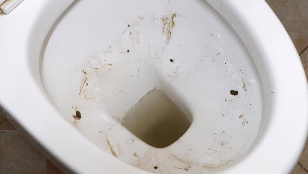 马桶内的黄色污垢怎么去除,马桶里面的黄色污垢怎么去除