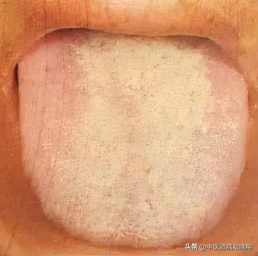 刘主任让病人伸舌头，看的是什么？