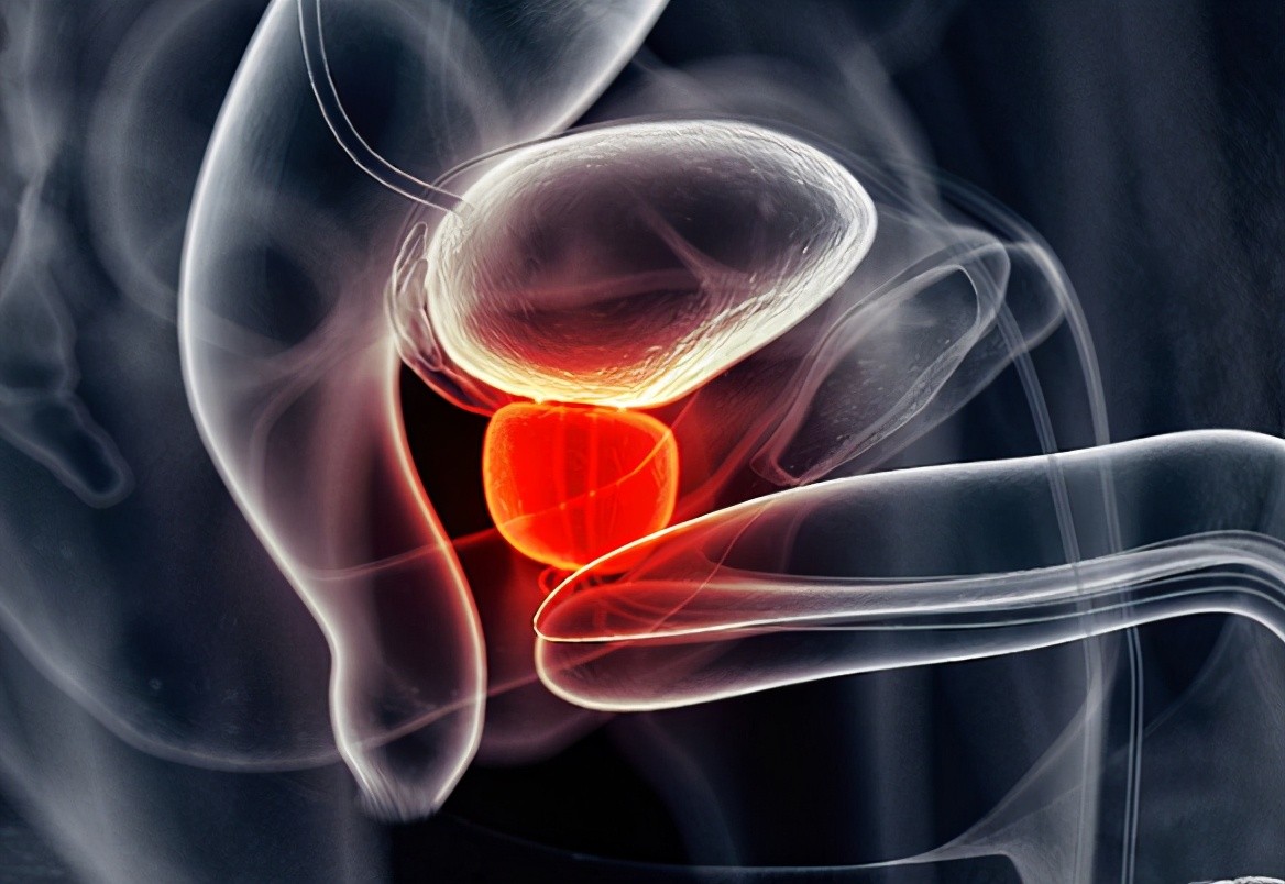 远离前列腺的最佳方法,前列腺最怕这六个坏习惯