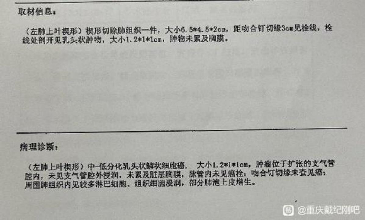 3个月内磨玻璃结节,多发磨玻璃结节3个月后减少