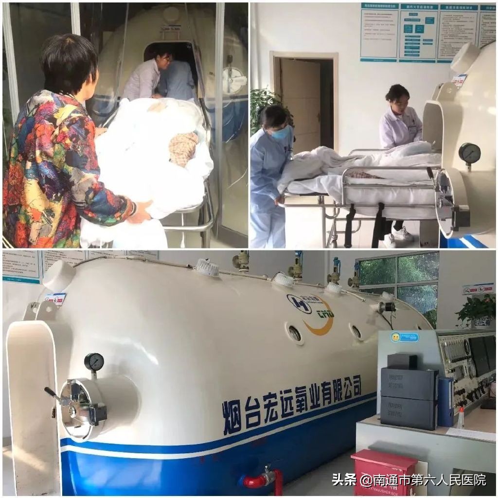 高压氧治疗昏迷成功案例,南通第一人民医院高压氧单人舱