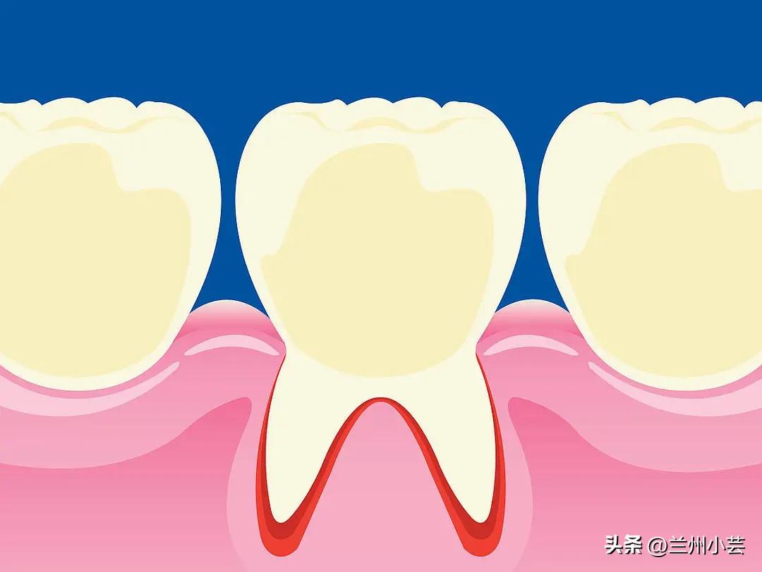 牙疼要人命怎么根治,牙疼要人命是有说法的