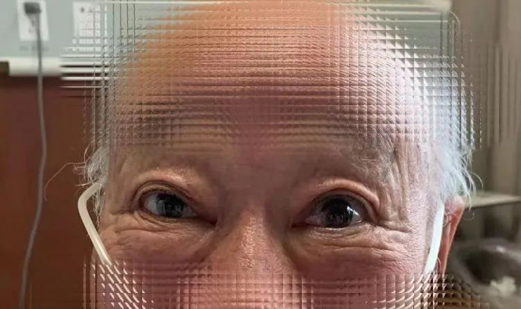 眼皮抬不起来了真困,眼皮抬不起来是阳吗