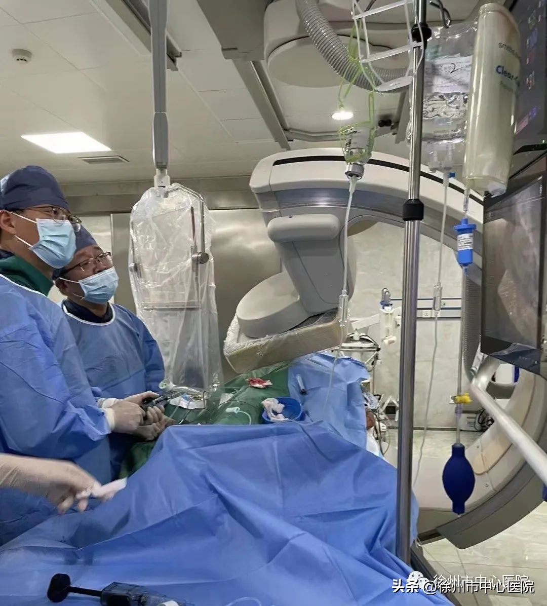 声波治疗心血管钙化,心脏血管钙化用震波球囊操作过程