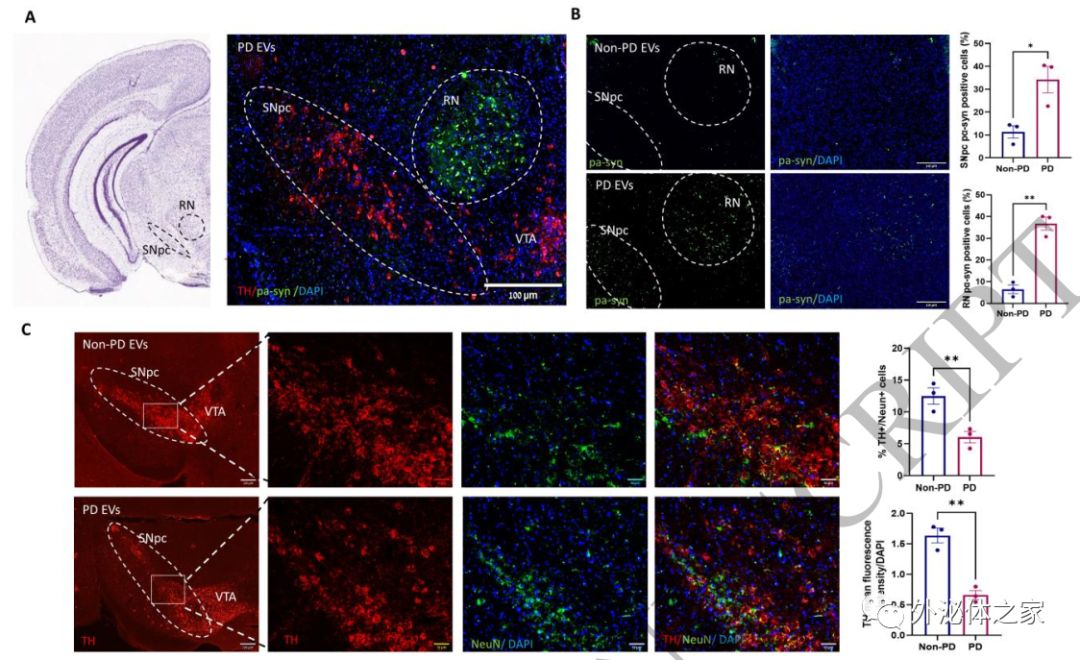 世界帕金森病日第28个主题,世界帕金森病日完整版