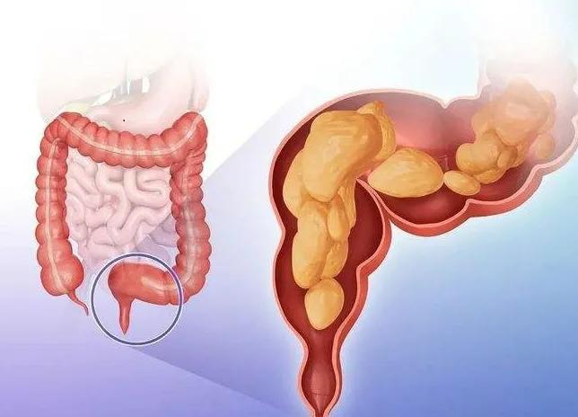 最适合放疗的癌症,哪种肿瘤需要放疗