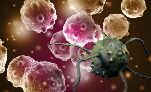 腺癌的症状和前兆,转移性腺癌属于什么癌症