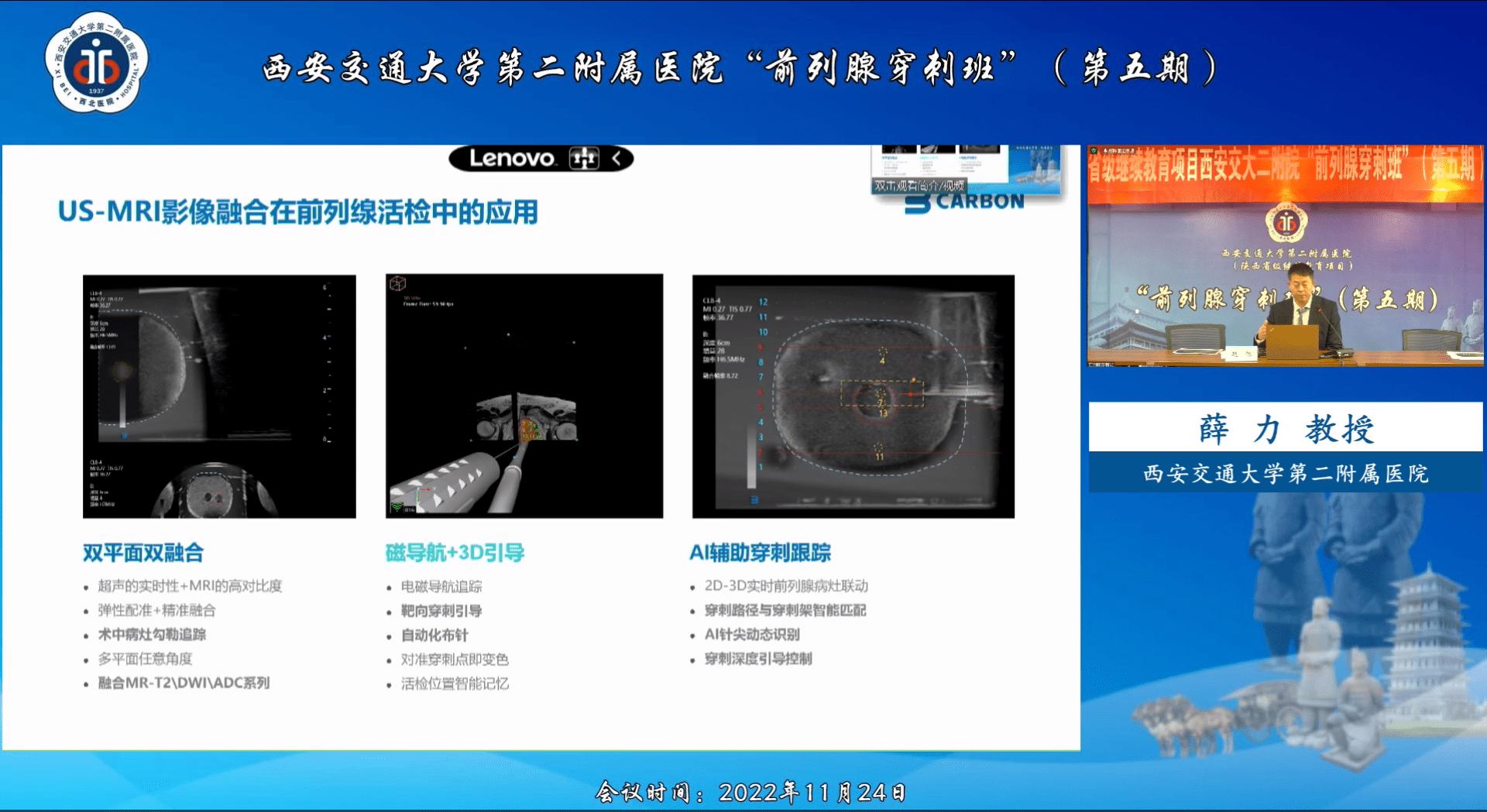 新技术赋能西安交通大学第二附属医院前列腺精准靶向穿刺新突破
