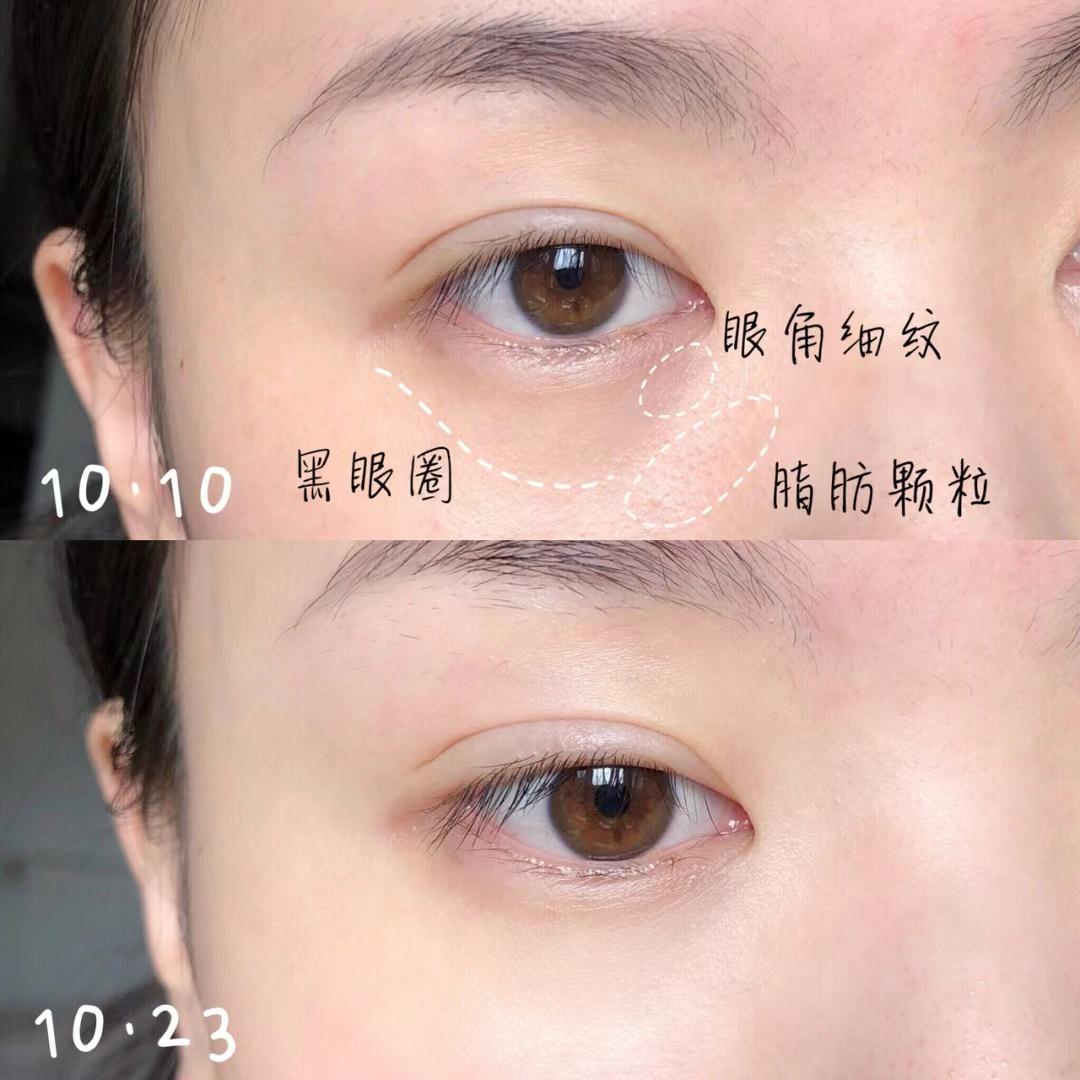 眼霜正确涂法和要避免的误区,眼霜涂不涂的区别