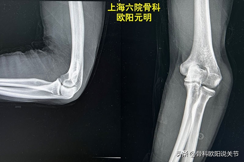 名医讲述滑膜炎,名医专访骨科医生