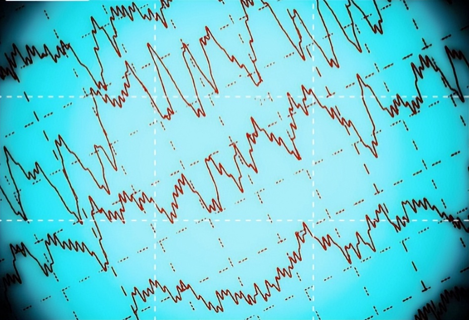 大脑异常放电会全身震颤吗,大脑异常放电一定会引起抽搐吗