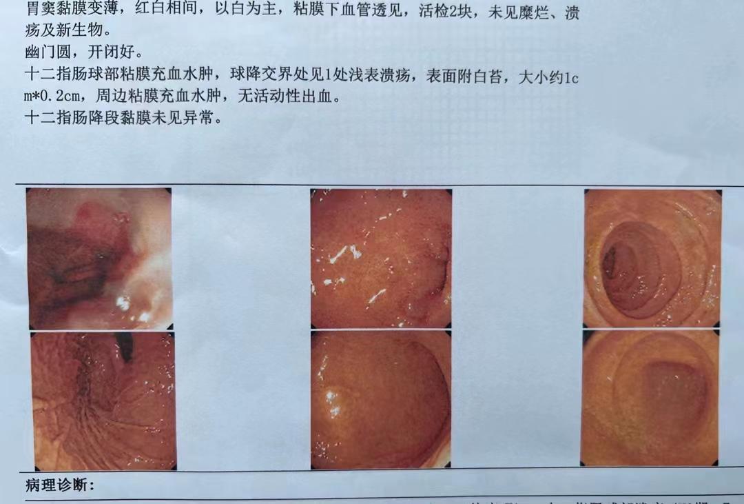 胃肠镜检查出问题该怎么做,胃肠镜检查发现问题怎么处理