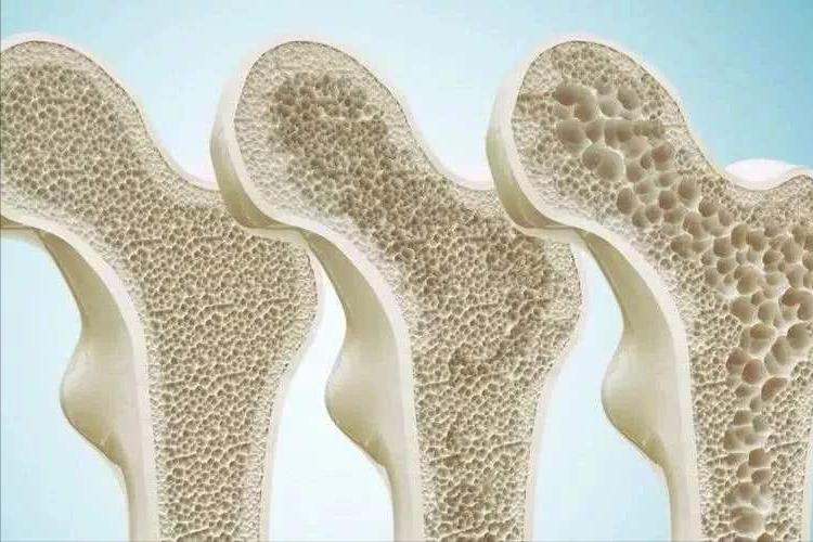 女性绝经并非全是“坏事”！或能给身体带来这3大好处，不妨看看