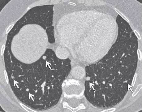 人到中年最好的解决方法,人到中年一堆病怎么办