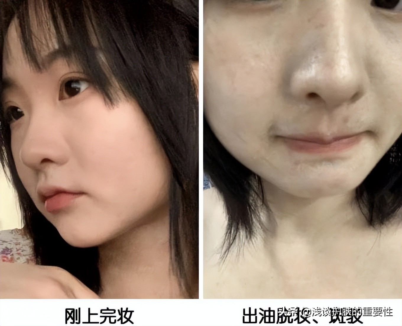 一到夏天皮肤就容易出油,一到夏天脸上出油用什么护肤品