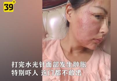 大连女孩打美容针毁容,大连一女子打玻尿酸