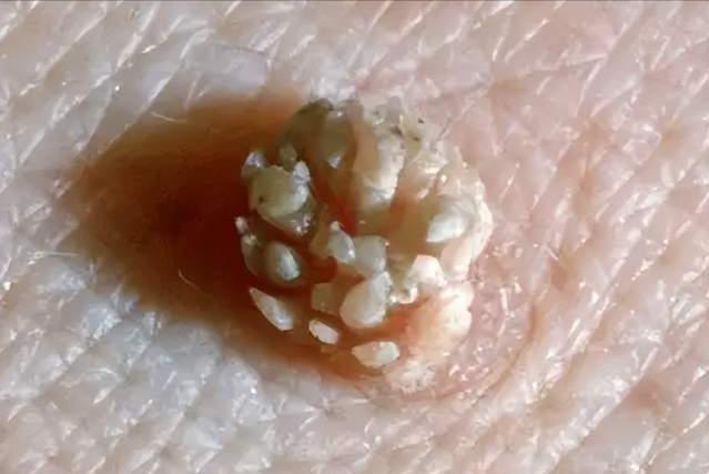 安全套“套”上就完事？这4个错误做法，不少男性还没意识到