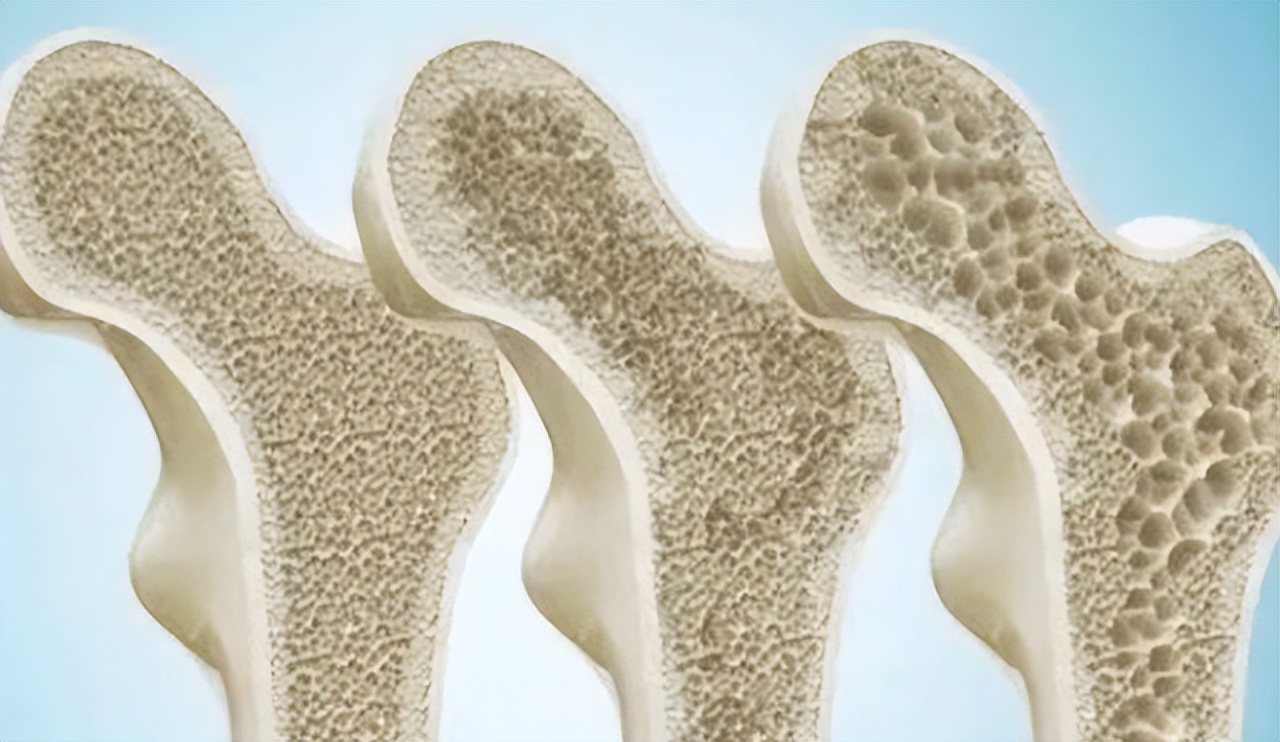 55岁男性体检应该检查哪些项目,体检一般检查哪些项目能预防癌症