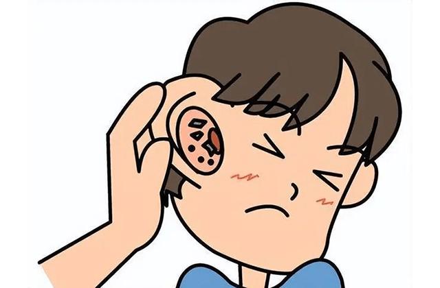 耳朵发痒怎么办？潍坊耳鼻喉医院分享快速缓解症状的有效技巧