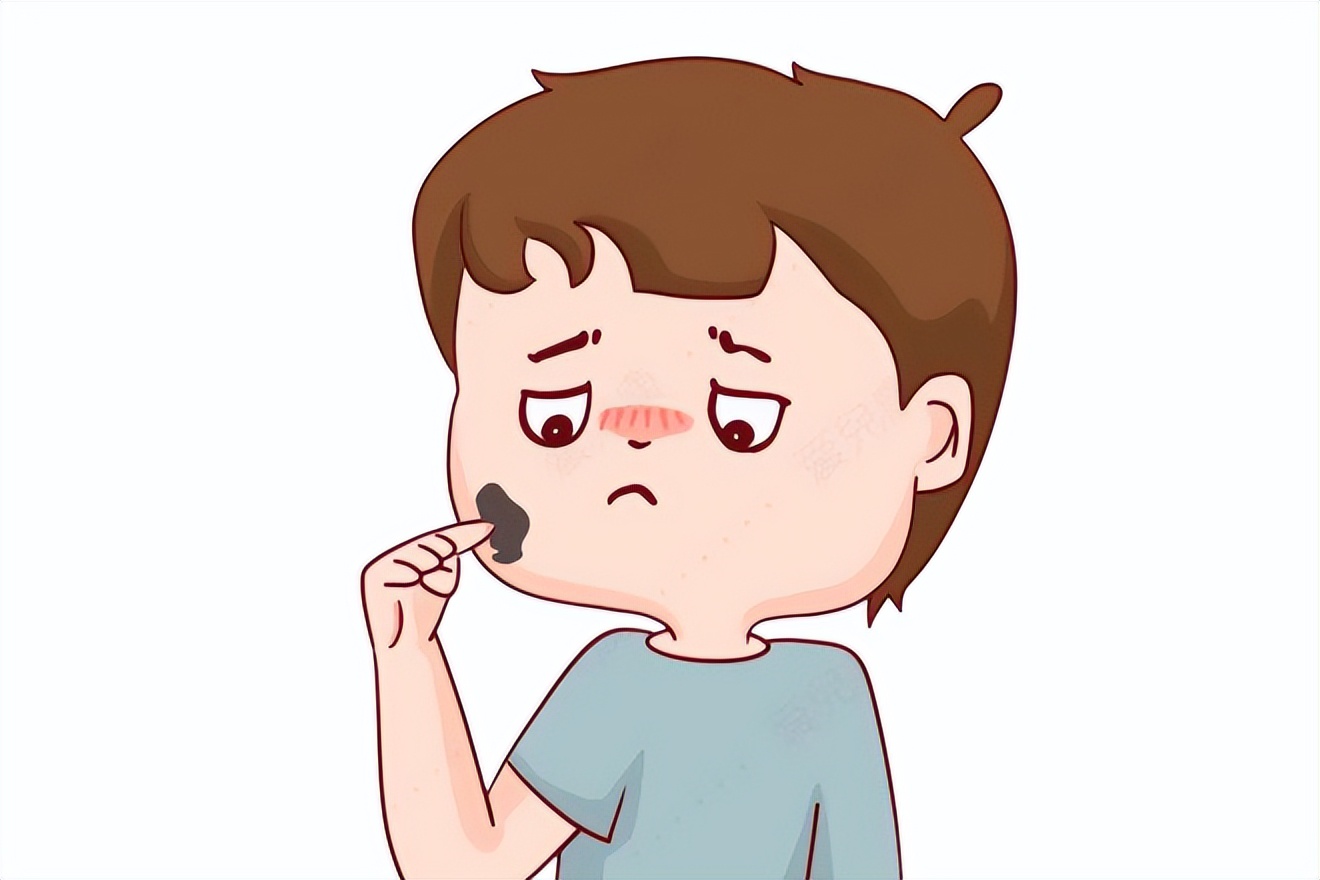 长毛痣怎么治最有效果,嘴角痣长毛凸起能点吗