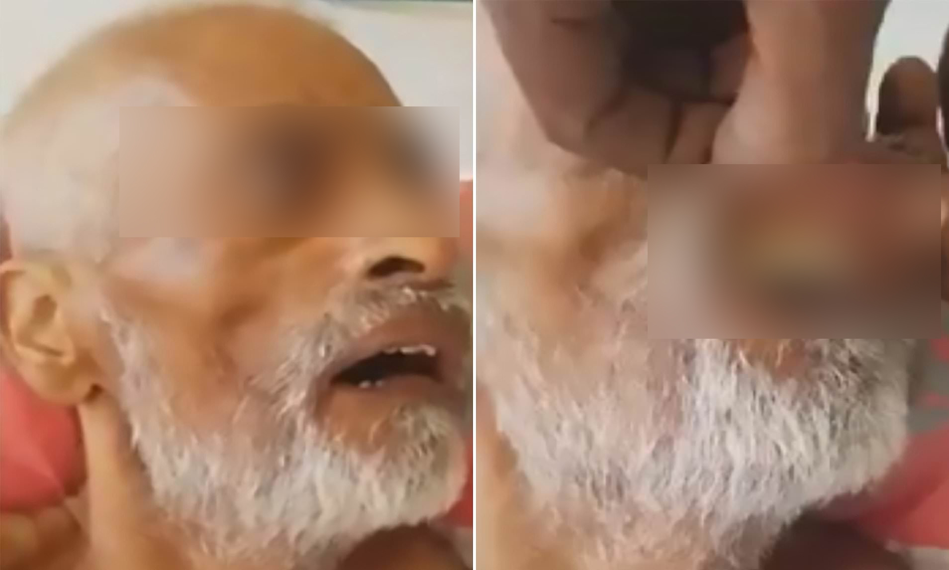 为啥身上会长蛆虫,人身上有蛆虫是什么原因