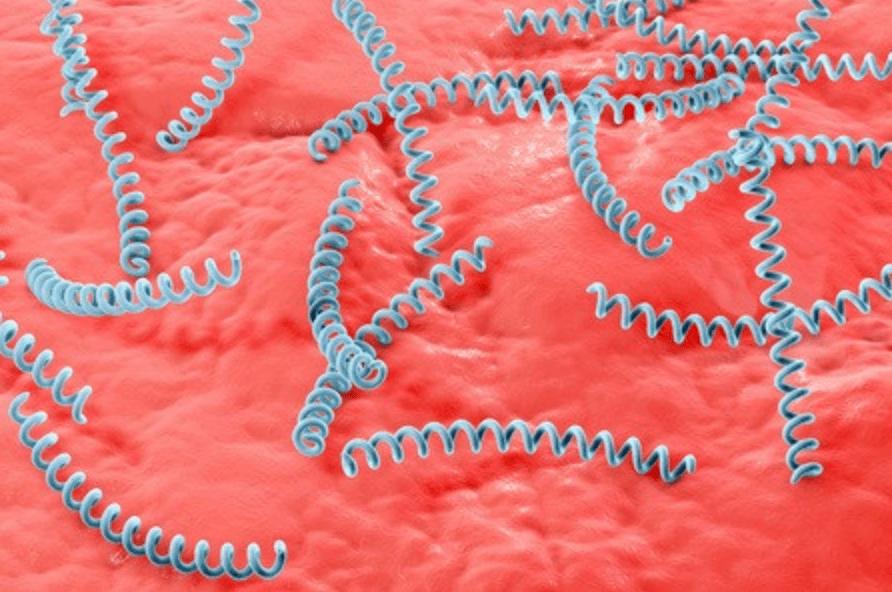 得了梅毒会有什么症状,得了梅毒会有哪些症状