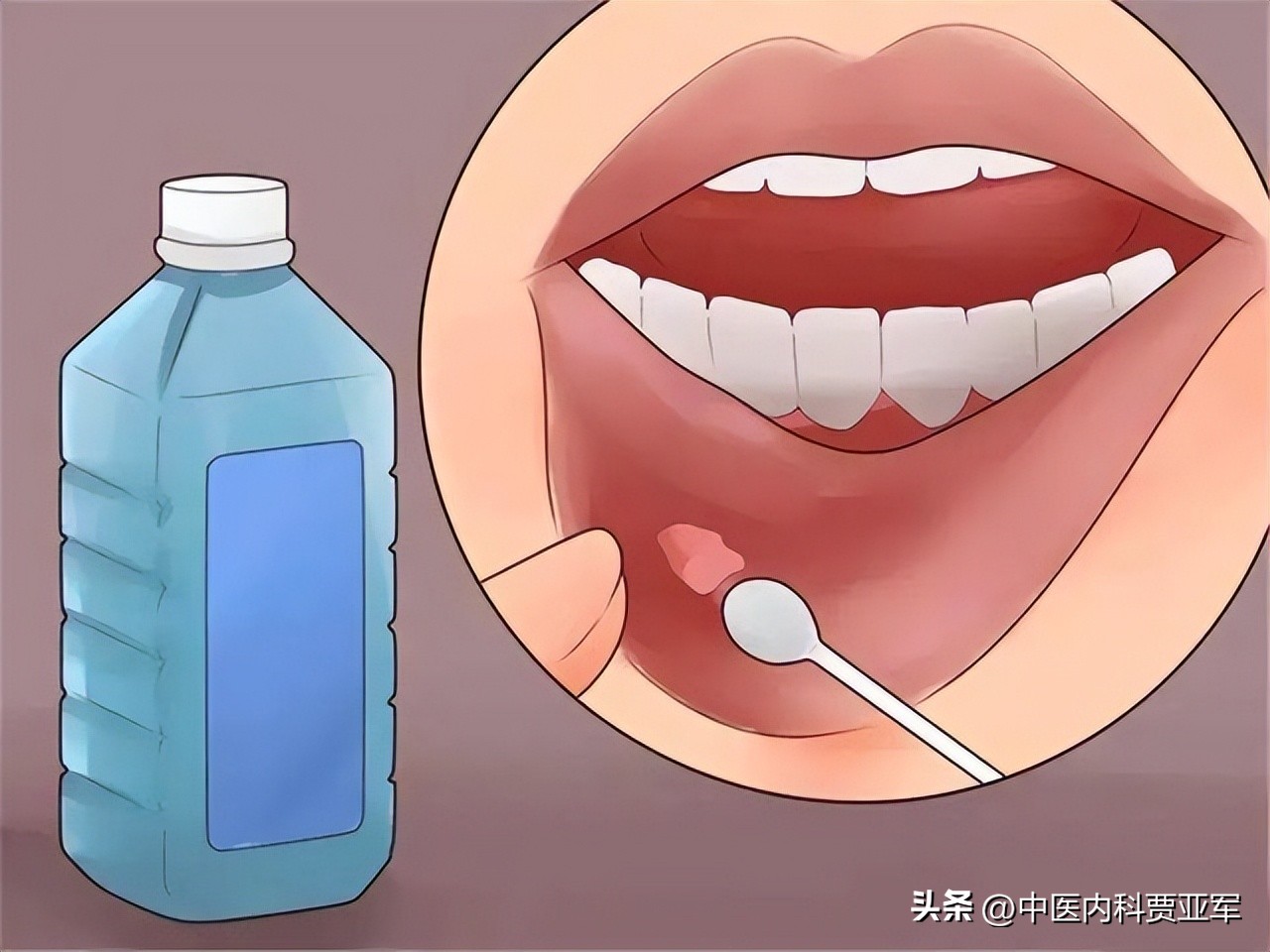 虚火上升用什么样中成药,虚火上升的中成药