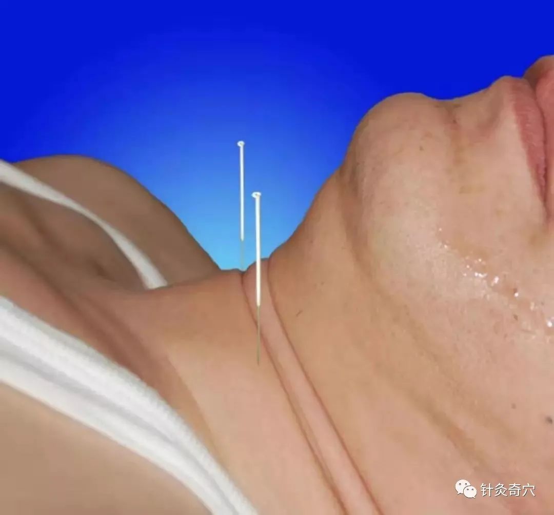 史上最全中医针灸视频教程全集,针灸治疗真实图片大全