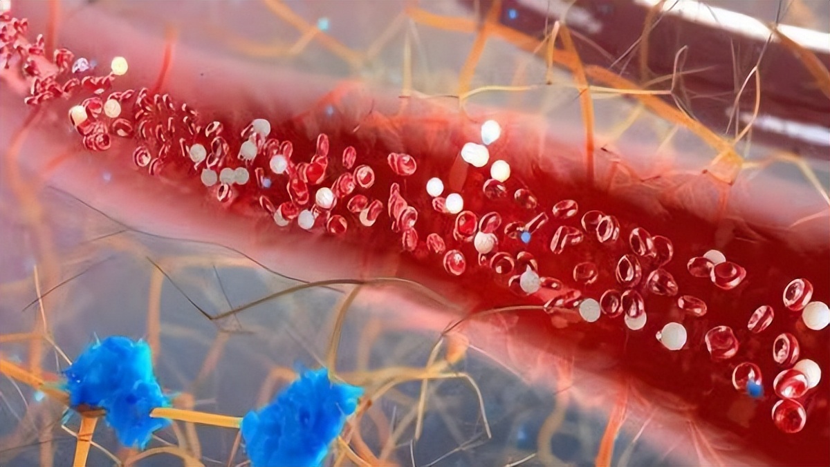 脑梗为什么不能吃海带,脑梗病人吃海带到底好不好